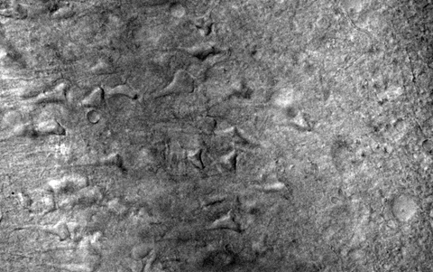 Entorhinal Cortex