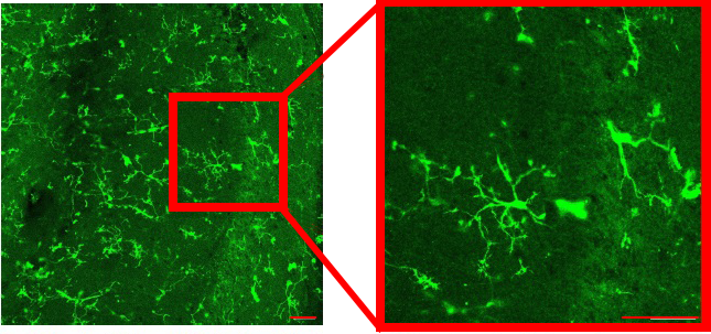 Hippocampus slice