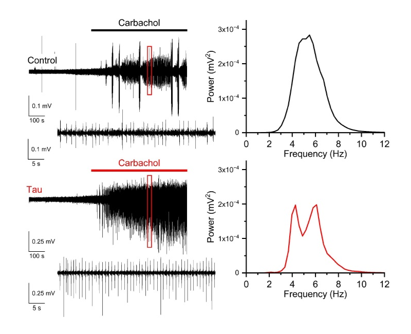 Oscillations in slices from 3 week-old mice